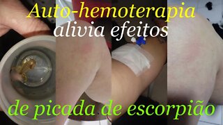 AUTO-HEMOTERAPIA RECUPERA E ALIVIA EFEITOS DE PICADA DE ESCORPIÃO
