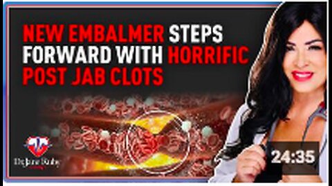 New Embalmer Steps Forward With Horrific Post Jab Clots