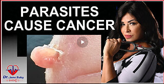 THEY KNOW: PARASITES ARE THE CAUSE OF CANCER