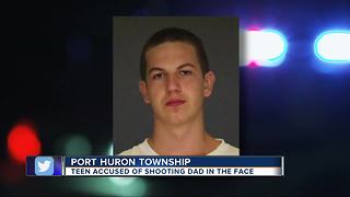 Teenager accused of shooting his father in the face