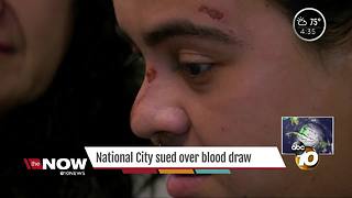 National City sued over blood draw