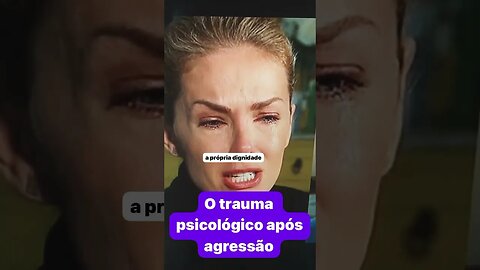 ApresentadoraAna Hickmann após agressão do marido Alexandre Correia ainda não acabou￼