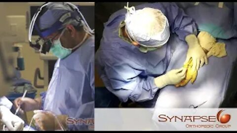 Removal of Mass from the Hand Patient Testimonial
