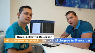 Knee Arthritis Reversed - 4th degree osteoarthritis to 2nd degree in 9 months