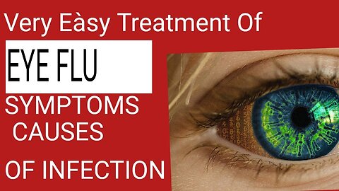 Easy Treatment of Eye Viral infection