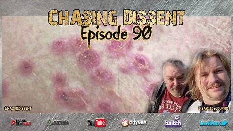 Monkey Pox - Be Afraid? Chasing Dissent LIVE Episode 90