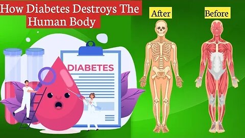 How Diabetes Destroys The Human Body | What you need to know | Medical Animation By Behealthy.