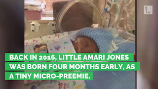 15-Ounce Micro-Preemie Born the Size of a Smartphone, See Him Now 2 Years Later