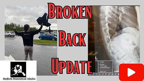 Best video ever made in Alaska! Last Doctors appointment for broken teen boys back. #broken #healed