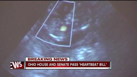 Ohio lawmakers approve ban on abortions after detection of fetal heartbeat