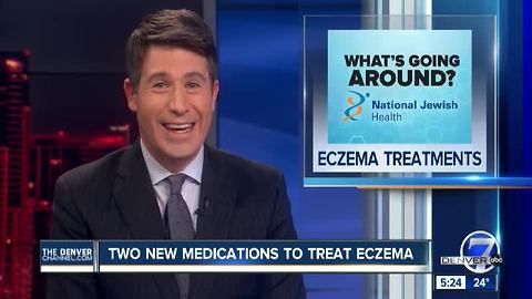 Eczema Treatments