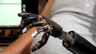 $120 Million Prosthetic Arm