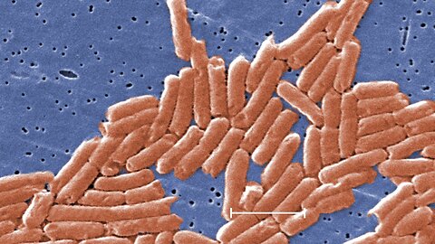 CDC Warns Of New Salmonella Strain Resistant To Antibiotics