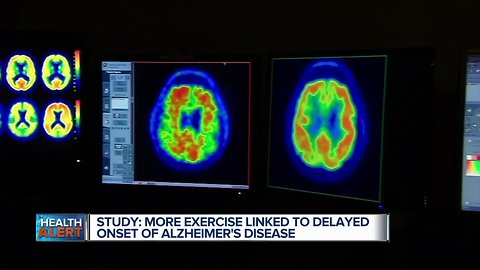 Study: More exercise linked to delayed onset of Alzheimer’s