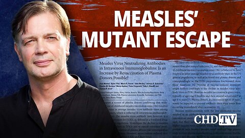 Andrew Wakefield: We Should Be Concerned About Measles.