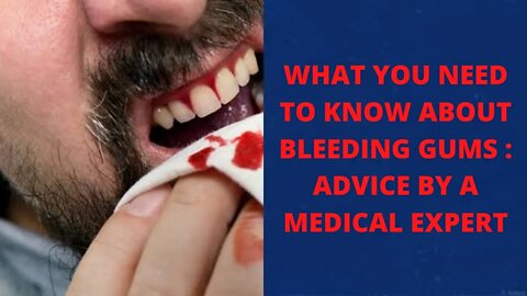 What You Need to Know About Bleeding Gums : Advice by a medical Expert