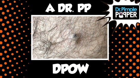 The Jungle Is Dark, but Full of Diamonds... A Dr Pimple Popper DPOW