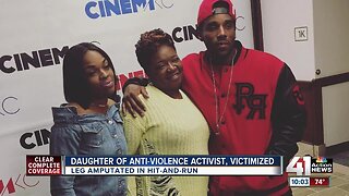 Daughter of activist injured in hit-and-run