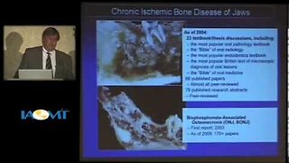 Bone Diseases of the Jaw