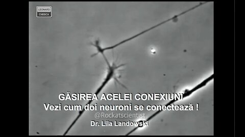 GĂSIREA ACELEI CONEXIUNI , e uimitor cum doi neuroni se conectează !