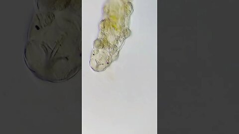 Tardigrade (water bears) 400x and 2x phone zoom #microscope #microbiology #shorts