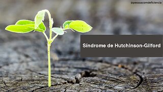 Você sabe o que é Síndrome de Hutchinson-Gilford (Progeria) ?