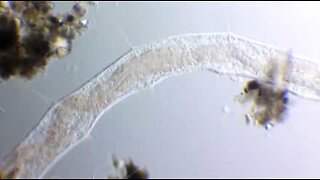 Impressionanti immagini di un verme al microscopio