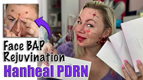 Full Face Bap with Hanheal PDRN! AceCosm, Code Jessica10 Saves you Money