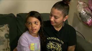 8-year-old girl survives hit and run accident near 35th and North