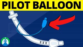 Pilot Balloon (Medical Definition) | Quick Explainer Video