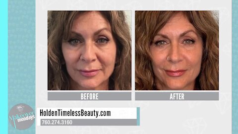 Makeover Mondays: Holden Timeless Beauty Discusses Liquid Facelifts