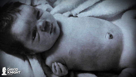 Dangers of RNA Vaccine for Fetuses: Remember Thalidomide Babies?