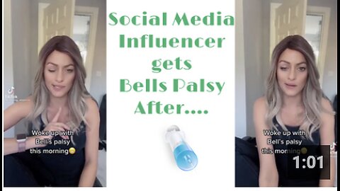 Social Media influencer gets Bells Palsy After💉