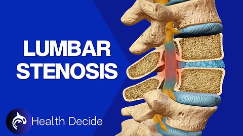 What is Lumbar Spinal Stenosis?