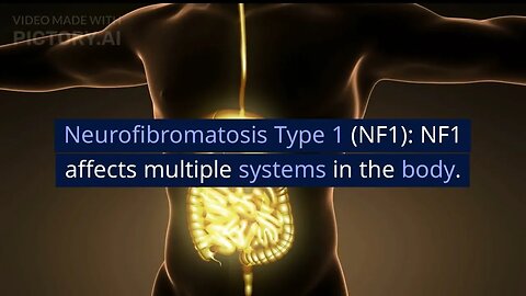 Neurofibromatosis Type 1 and it's effects || Neurofibromatosis #nofearwithneurofibromatosis