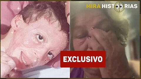 Lembra da menina QUEI’MADA por um equívoco do vizinho? Ela reapareceu com a avó contando sua triste