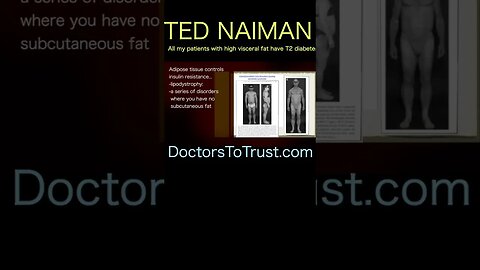 Ted Naiman C