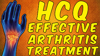 Hydroxychloroquine (HCQ) Effective Rheumatoid Arthritis Treatment - 7 Reviews