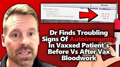 Dr.Nathan Thompson: "My jaw dropped when I tested someone´s immune system after the 2nd jab"