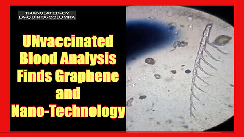 🩸 Microscopic Analysis Shows the Blood of a 55 Year Old Patient That is NOT Vaccinated But Was Test Swabbed For Covid (subtitles) * Detox Info Below 👇