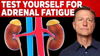 How To Test Yourself For Adrenal Fatigue – Dr. Berg On Adrenal Insufficiency