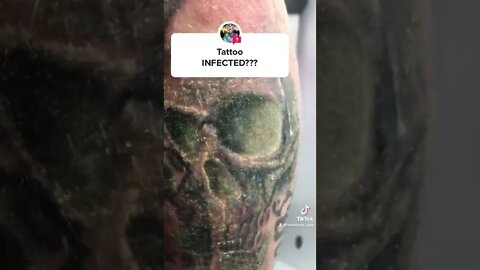 Tattoo INFECTED? Has THIS happened to YOU?