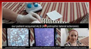 LQC: MICROSCOPIC ANALYSIS OF A DROP OF BLOOD FROM A PERSON "VACCINATED" WITH SINOPHARM