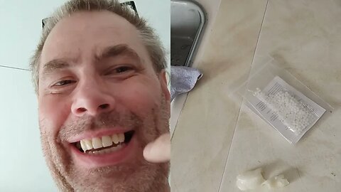Offtopic:Tooth gap inserts - how to fix your teeth problems + Free Energy convention f. R.Friedrich