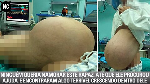 Ninguém queria namorar este rapaz. Até que ele procurou ajuda, e encontraram algo terrível crescendo