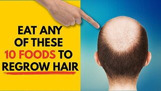 10 Best Foods To Regrow Your Hair - Foods for Hair Growth