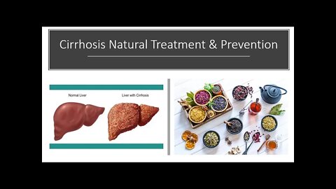 Cirrhosis Of The Liver - Natural Treatment