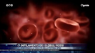 NWO, VACCINI: Effetti Avversi, Spike e Globuli Rossi, Byoblu 5/01/2023