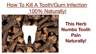 How To Kill Tooth & Gum Infections + Numb Pain 100% Naturally!
