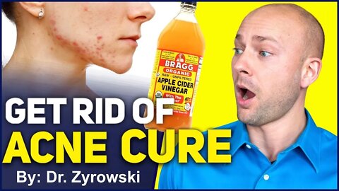 Miracle Acne Cure - Apple Cider Vinegar & How To Get Rid Of Acne | Dr. Nick Z.